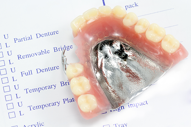 金属アレルギーがある